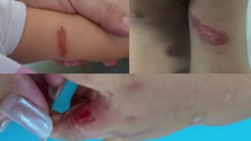 escola-infantil-suspende-aulas-apos-bebes-sofrerem-infeccoes-em-fortaleza