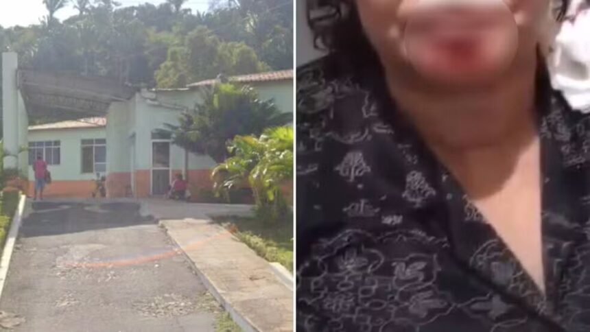 professor-vira-reu-apos-arrancar-pedaco-de-queixo-da-namorada-com-mordida