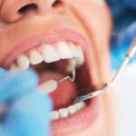 quer-se-atualizar-na-area-de-odontologia?-confira-os-cursos-da-pos-unifor