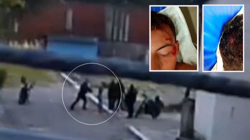 mp-cobra-que-estado-indenize-jovem-autista-agredido-por-policiais-com-pancada-na-cabeca
